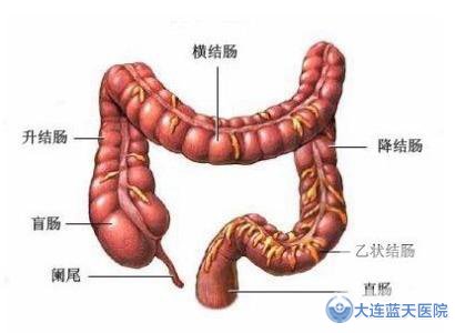 慢性结肠炎