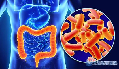 大连春柳胃肠科门诊部结肠炎应该怎么办？